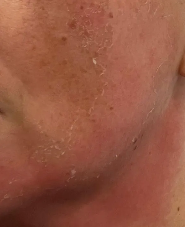 Kräuterstempel Massage von Kala Nui Wellness und Kosmetik