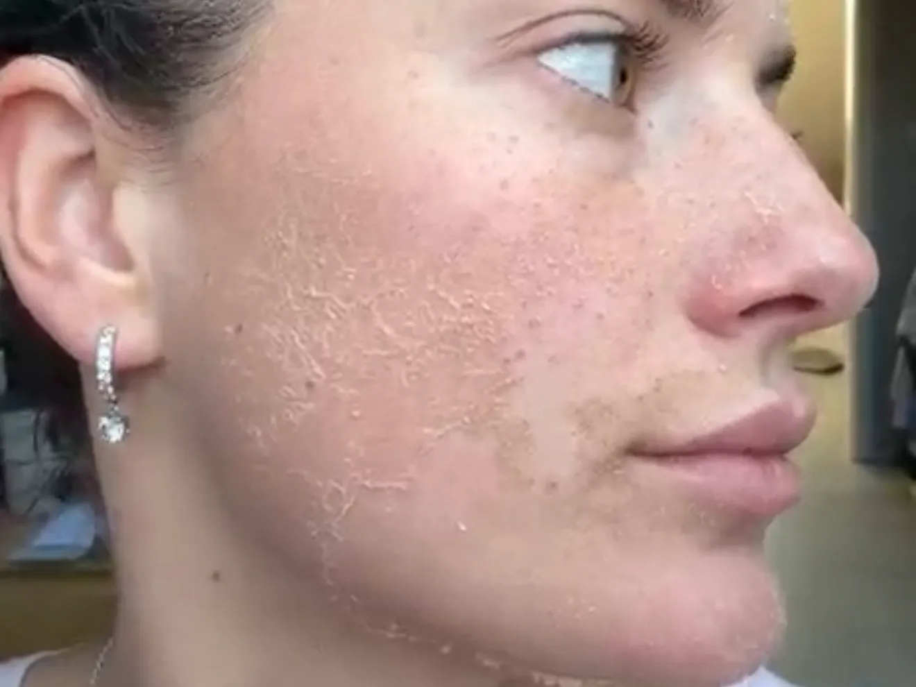 GREEN PEEL® Kräuterschälkur Classic