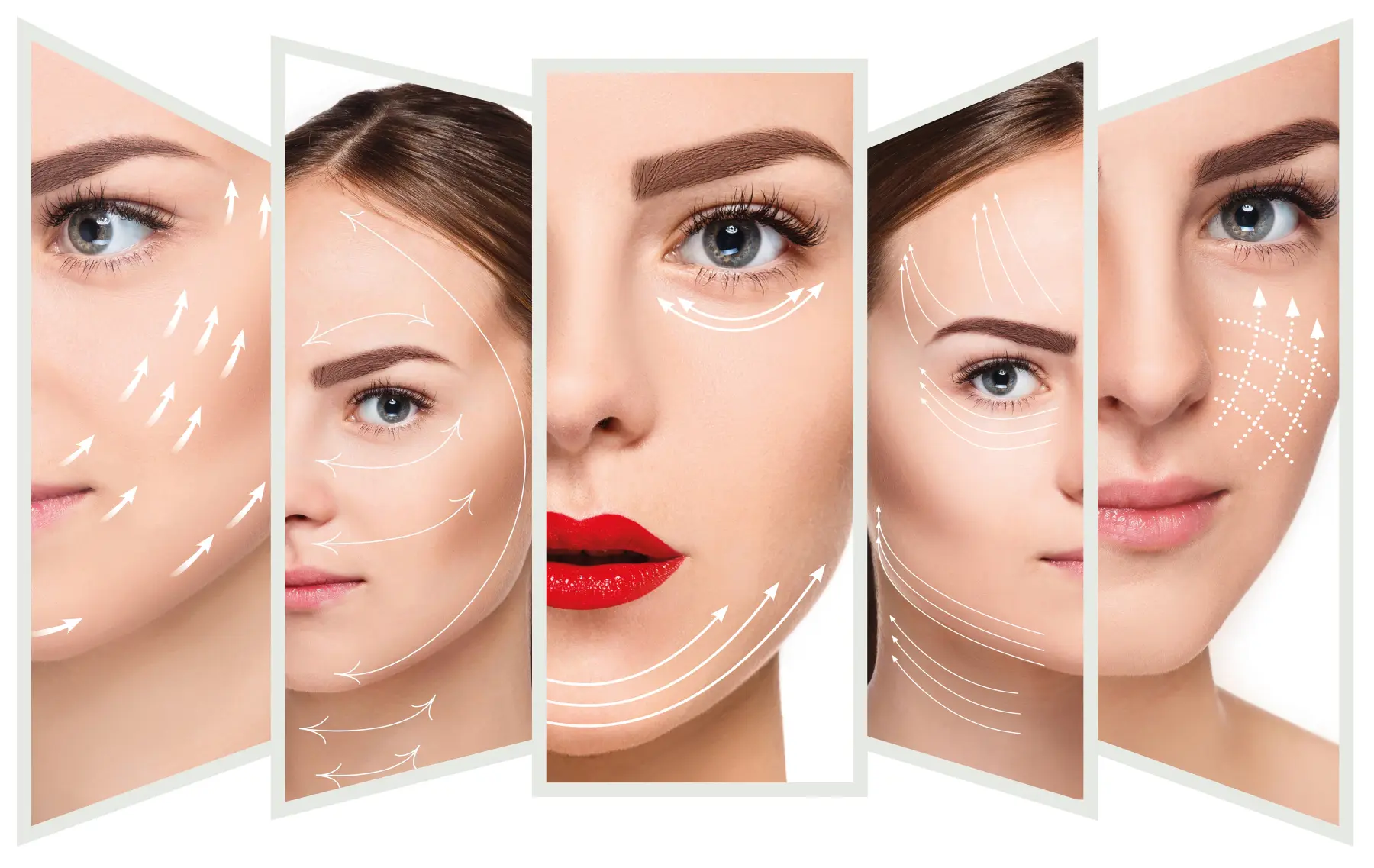 Radiofrequenztherapie von Kala Nui Wellness und Kosmetik