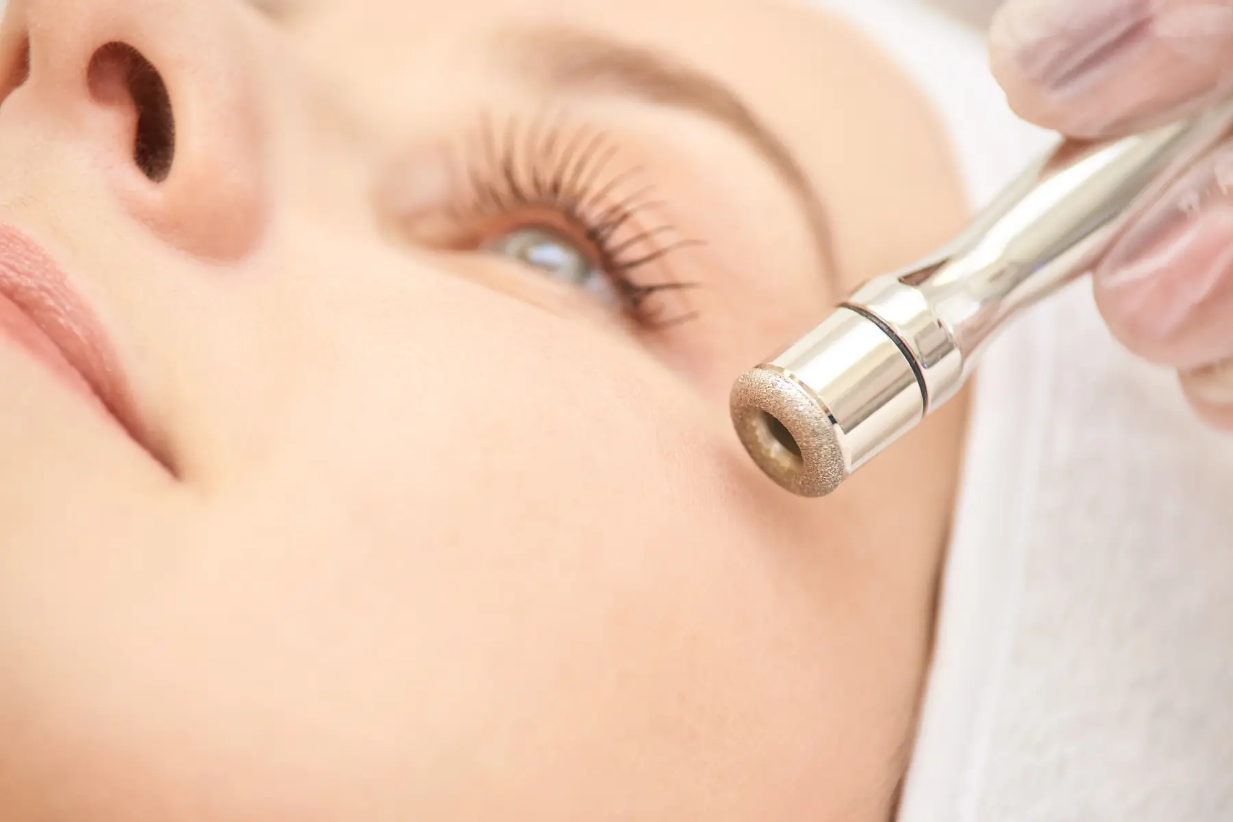 Mikrodermabrasion von Kala Nui Wellness und Kosmetik