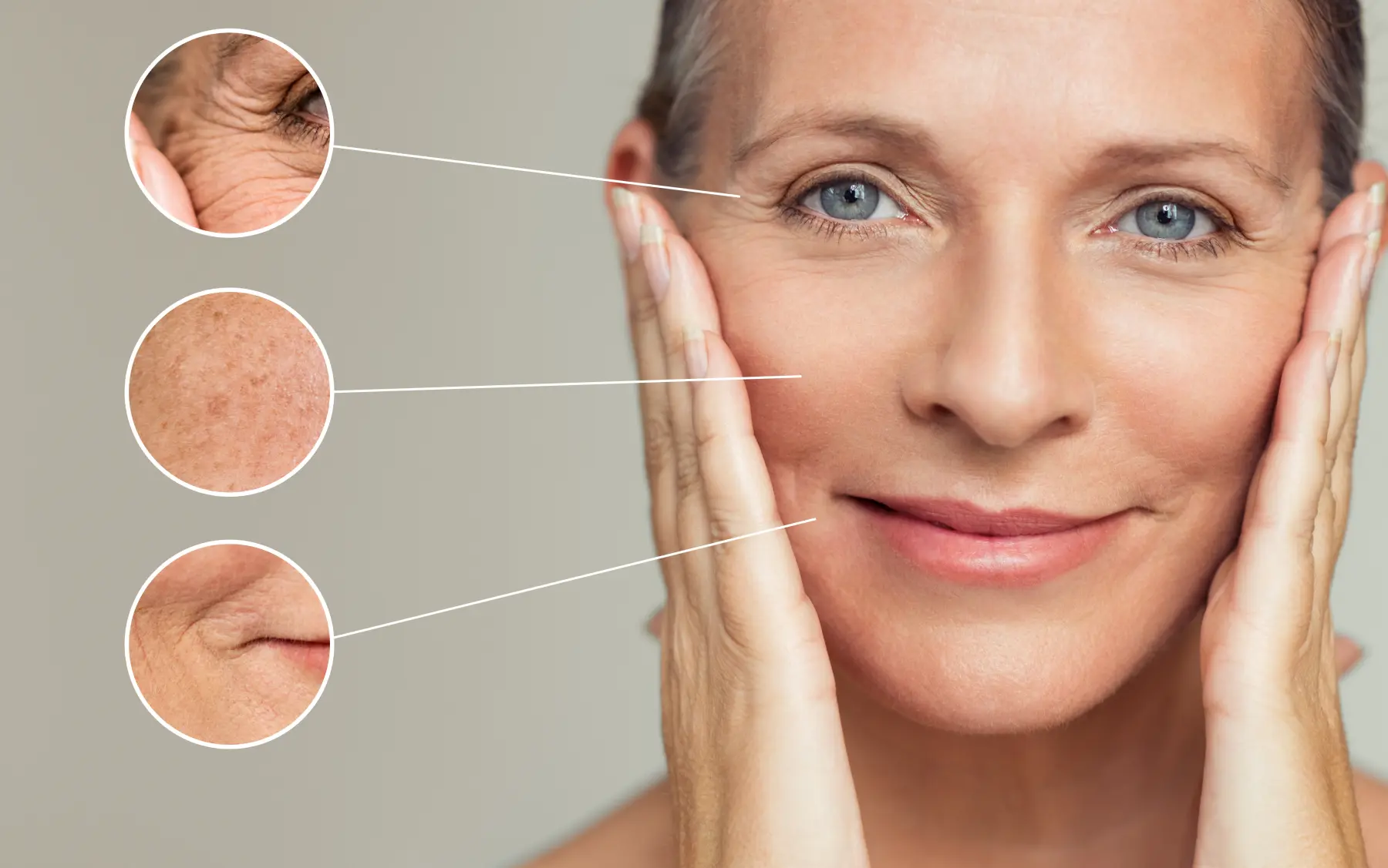 Tixel-Behandlung von Kala Nui Wellness und Kosmetik