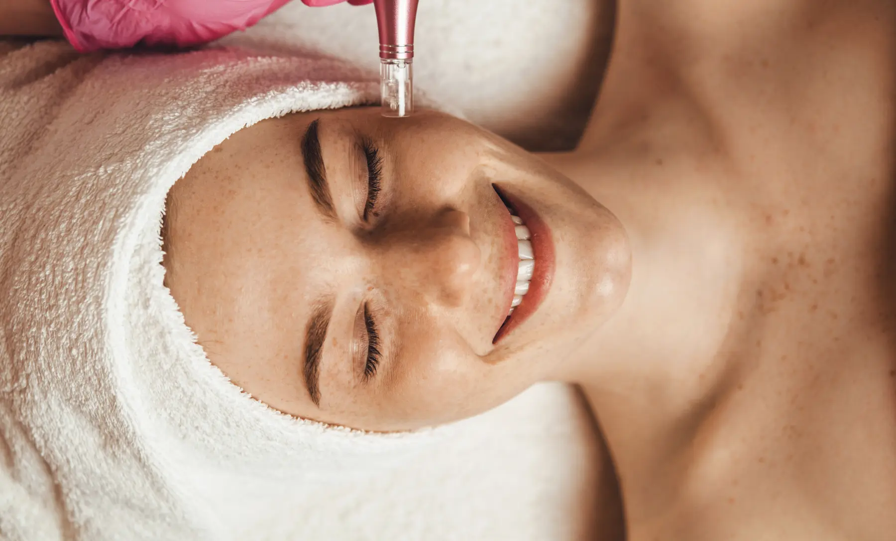 BB Glow vs. Microneedling